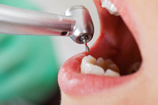 Best Emergency Denture Repair in Frankenmuth, MI